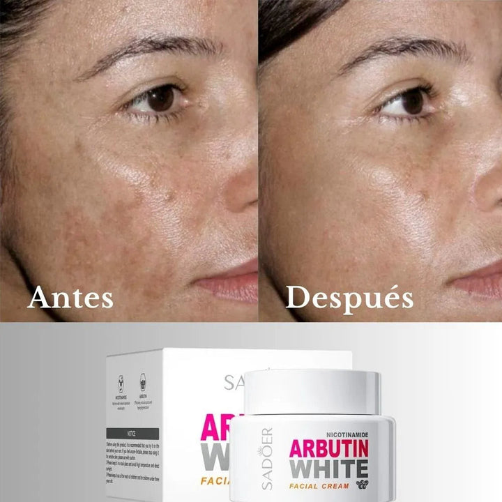 ARBUTIN WHITE